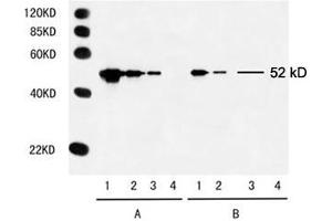 Multiple Tag Cell Lysate (ABIN1536505) Primary antibody: A. (Myc Tag 抗体)