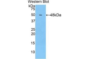Detection of Recombinant COL14, Human using Polyclonal Antibody to Collagen Type XIV (COL14) (COL14A1 抗体  (AA 1280-1461))