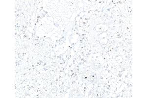 Immunohistochemistry (IHC) image for anti-Achaete-Scute Complex Homolog 1 (Drosophila) (ASCL1) (AA 186-236) antibody (ABIN7455113)