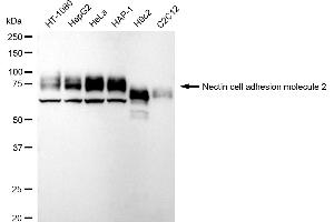 Western blotting analysis using LPP antibody (ABIN7799277). (Recombinant LPP 抗体)