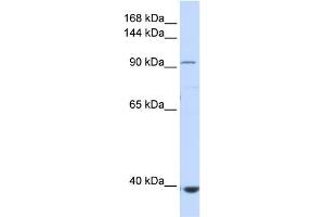 WB Suggested Anti-IFIH1 Antibody Titration:  0. (IFIH1 抗体  (Middle Region))