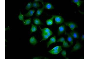 Immunofluorescence staining of A549 cells with ABIN7149328 at 1:100, counter-stained with DAPI. (CYFIP1 抗体  (AA 320-449))