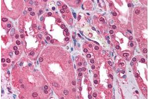 Human Kidney (formalin-fixed, paraffin-embedded) stained with ATM antibody ABIN213900 at 1-2 ug/ml followed by biotinylated goat anti-rabbit IgG secondary antibody ABIN481713, alkaline phosphatase-streptavidin and chromogen. (ATM 抗体  (C-Term))