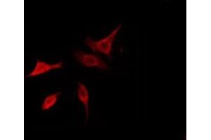 ABIN6278556 staining HeLa by IF/ICC. (CARD10 抗体  (N-Term))