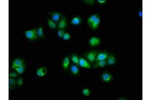 Immunofluorescence staining of HepG2 cells with ABIN7172220 at 1:100, counter-stained with DAPI. (Titin 抗体  (AA 5398-5604))