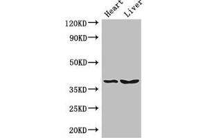 Western Blot Positive WB detected in: Mouse heart tissue, Mouse liver tissue All lanes: CTSB antibody at 3 μg/mL Secondary Goat polyclonal to rabbit IgG at 1/50000 dilution Predicted band size: 38 kDa Observed band size: 38 kDa (Cathepsin B 抗体  (AA 82-333))