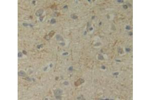IHC-P analysis of Human Tissue, with DAB staining. (Uracil Phosphoribosyltransferase (UPP) (AA 75-297) 抗体)