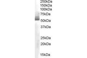 Image no. 1 for anti-Aldehyde Dehydrogenase 1 Family, Member A1 (ALDH1A1) (C-Term) antibody (ABIN374078) (ALDH1A1 抗体  (C-Term))