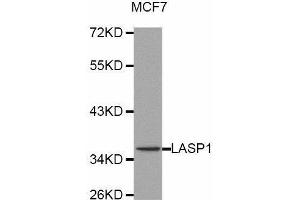 Western blot analysis of extracts of MCF7 cell line, using LASP1 antibody. (LASP1 抗体  (AA 130-205))