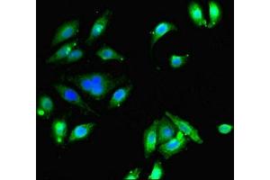 Immunofluorescent analysis of A549 cells using ABIN7152056 at dilution of 1:100 and Alexa Fluor 488-congugated AffiniPure Goat Anti-Rabbit IgG(H+L) (Ethanolamine Kinase 1 抗体  (AA 90-258))