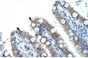 Immunohistochemical staining (Formalin-fixed paraffin-embedded sections) of human intestine with MECOM polyclonal antibody . (MECOM 抗体  (AA 964-1013))