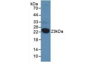 Detection of Recombinant DUSP3, Human using Monoclonal Antibody to Dual Specificity Phosphatase 3 (DUSP3)