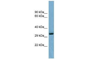 WB Suggested Anti-OTUD6B Antibody Titration: 0. (OTUD6B 抗体  (Middle Region))