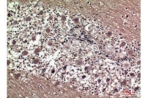 Immunohistochemistry (IHC) analysis of paraffin-embedded Human Brain, antibody was diluted at 1:100.