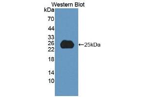 Western blot analysis of recombinant Human SPP2. (SPP2 抗体  (AA 30-211))