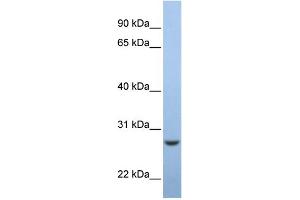 WB Suggested Anti-C15orf24 Antibody Titration:  0. (Emc7 抗体  (Middle Region))