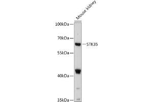 Western blot analysis of extracts of Mouse kidney, using STK35 antibody (ABIN7270225) at 1:1000 dilution.