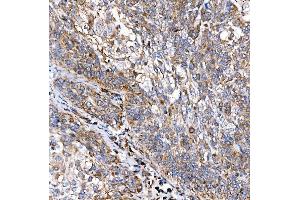 IHC analysis of RAB7/RAB7A using anti-RAB7/RAB7A antibody (ABIN7600597). (RAB7A 抗体  (AA 21-177))