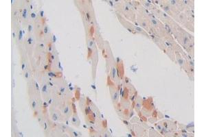 DAB staining on IHC-P; Samples: Mouse Heart Tissue (SHBG 抗体  (AA 53-214))