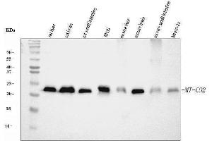 Western blot analysis of MT-CO2 using anti-MT-CO2 antibody (ABIN7599081). (COX2 抗体  (AA 1-205))