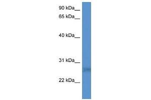 Western Blotting (WB) image for anti-SplA/ryanodine Receptor Domain and SOCS Box Containing 2 (SPSB2) (N-Term) antibody (ABIN926547)