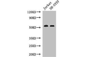 Western Blot Positive WB detected in: Jurkat whole cell lysate, SH-SY5Y whole cell lysate All lanes: TGFBR1 antibody at 4 μg/mL Secondary Goat polyclonal to rabbit IgG at 1/50000 dilution Predicted band size: 56, 57, 48 kDa Observed band size: 56 kDa (TGFBR1 抗体  (AA 157-244))
