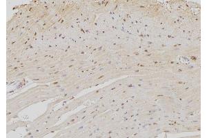 ABIN6273372 at 1/100 staining Rat heart tissue by IHC-P. (NOC4L 抗体  (Internal Region))