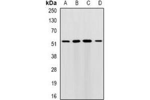 Western blot analysis of RMDN3 expression in HepG2 (A), MCF7 (B), mouse liver (C), mouse brain (D) whole cell lysates. (RMDN3 抗体)
