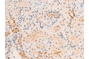 ABIN6267251 at 1/100 staining rat kidney tissue sections by IHC-P.