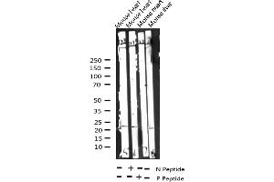 Western blot analysis of Phospho-CHOP (Ser30) expression in various lysates (DDIT3 抗体  (pSer30))