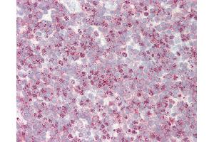 Immunohistochemistry (IHC) image for anti-Solute Carrier Family 24 (Sodium/potassium/calcium Exchanger), Member 1 (SLC24A1) (AA 612-661) antibody (ABIN6752963)