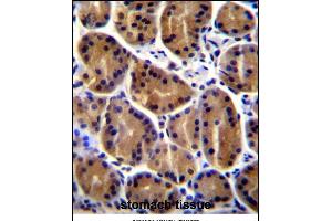 PKP2 Antibody (C-term) (ABIN656864 and ABIN2846068) immunohistochemistry analysis in formalin fixed and paraffin embedded human stomach tissue followed by peroxidase conjugation of the secondary antibody and DAB staining. (Plakophilin 2 抗体  (C-Term))