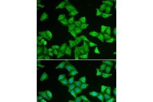Immunofluorescence analysis of U2OS cells using COX5A Polyclonal Antibody (COX5A 抗体)