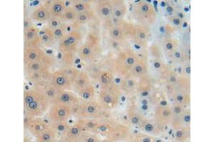 Used in DAB staining on fromalin fixed paraffin-embedded liver tissue (AGMAT 抗体  (AA 205-347))