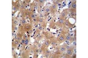 TRPM8 antibody immunohistochemistry analysis in formalin fixed and paraffin embedded human liver tissue. (TRPM8 抗体  (AA 263-292))