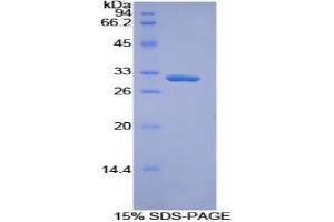 SDS-PAGE analysis of Mouse Torsin 3A Protein. (TOR3A 蛋白)