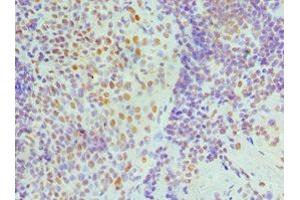 Immunohistochemistry of paraffin-embedded human tonsil tissue using ABIN7161690 at dilution of 1:100 (NONO 抗体  (AA 1-300))