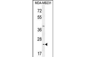 SYCE2 Antibody (N-term) (ABIN654371 and ABIN2844127) western blot analysis in MDA-M cell line lysates (35 μg/lane). (SYCE2 抗体  (N-Term))