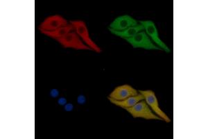 Phospho-IKK beta (Tyr188) Mouse Monoclonal Antibody staining Hela cells by IF/ICC.