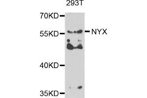 Western blot analysis of extracts of 293T cells, using NYX antibody. (Nyctalopin 抗体)