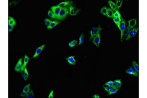 Immunofluorescent analysis of HepG2 cells using ABIN7158114 at dilution of 1:100 and Alexa Fluor 488-congugated AffiniPure Goat Anti-Rabbit IgG(H+L) (LRRTM4 抗体  (AA 259-419))