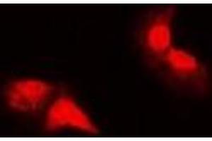 Immunofluorescent analysis of HER2 staining in MCF cells. (ErbB2/Her2 抗体  (C-Term))