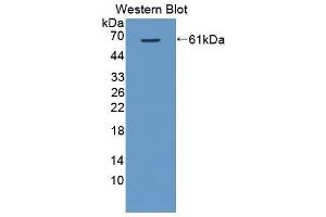 Western Blotting (WB) image for anti-VEGF Receptor 2 (VEGFR2) (AA 8-290) antibody (ABIN3206769) (VEGFR2/CD309 抗体  (AA 8-290))