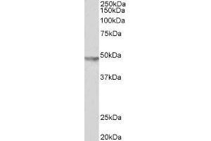 ABIN2562824 (2µg/ml) staining of Human Brain (Substantia Nigra) lysate (35µg protein in RIPA buffer). (KCNJ6 抗体  (C-Term))