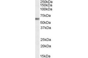 Western Blotting (WB) image for anti-Glycine/Arginine Rich Protein 1 (GRRP1) (N-Term) antibody (ABIN2791567) (GRRP1 抗体  (N-Term))