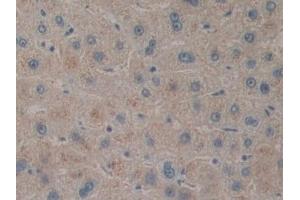Detection of PACAP in Human Liver Tissue using Polyclonal Antibody to Pituitary Adenylate Cyclase Activating Peptide (PACAP) (Pituitary Adenylate Cyclase Activating Peptide (AA 17-176) 抗体)