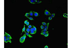 Immunofluorescence (IF) image for anti-Coiled-Coil Domain Containing 41 (CCDC41) (AA 34-260) antibody (ABIN7147433)