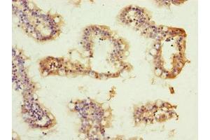 Immunohistochemistry (IHC) image for anti-ATP Synthase, H+ Transporting, Mitochondrial Fo Complex, Subunit D (ATP5H) (AA 1-161) antibody (ABIN7144845)