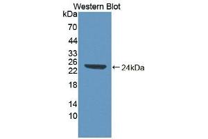 Detection of Recombinant ABI1, Human using Polyclonal Antibody to Abl Interactor 1 (ABI1) (ABI1 抗体  (AA 1-182))
