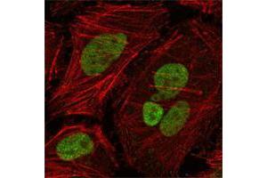Confocal immunofluorescence analysis of Hela cells using MLH1 mouse mAb (green), showing nuclear localization. (MLH1 抗体  (AA 381-483))